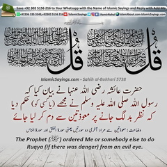 The Prophet pbuh ordered to do Ruqya from an evil eye